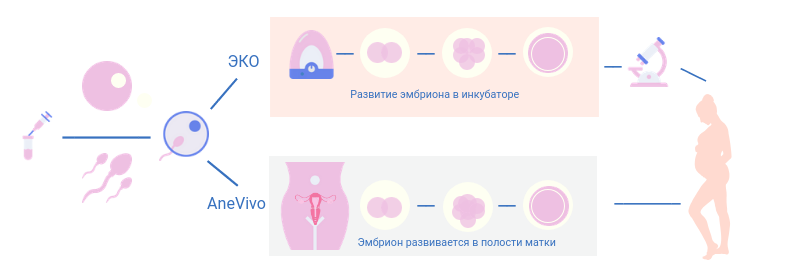 Инфографика о разнице методов ЭКО